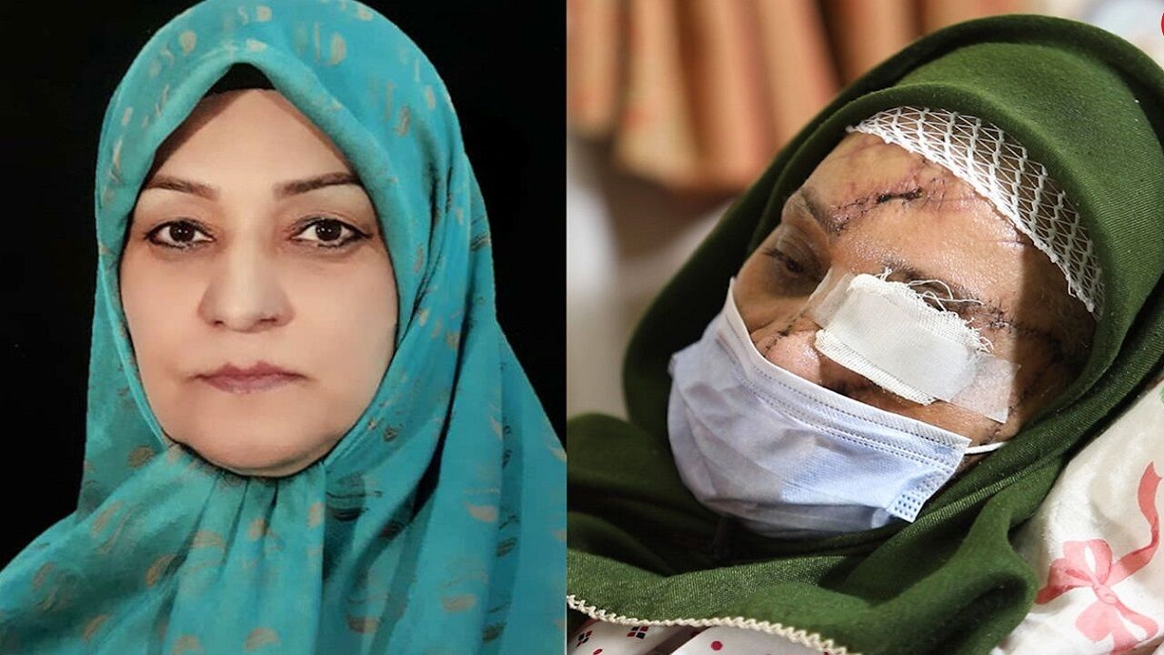 انگیزه مرد خشن از شکنجه بی‌رحمانه همسرش چه بود؟