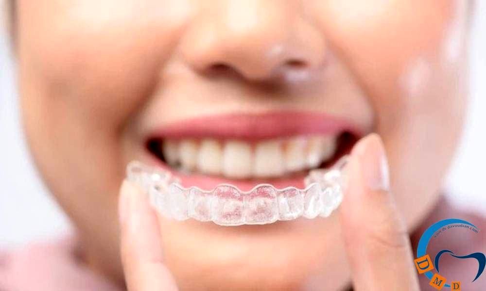مراحل ارتودنسی دو فک چگونه است؟