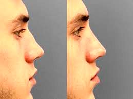 ارزیابی شرایط روحی فرد از طریق مدل بینی‌ ممکن شد