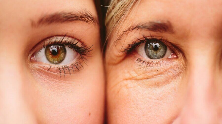 چین‌ و چروک پیشانی را جدی بگیرید؛ شاید به این بیماری مبتلا باشید