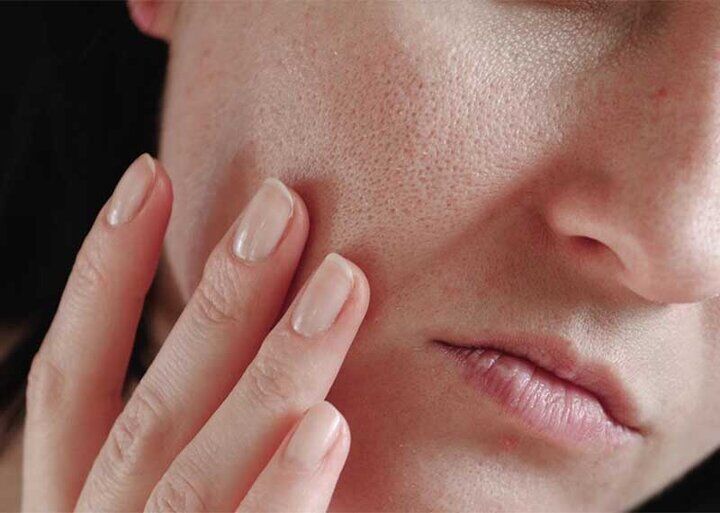 خاصیت خودترمیمی پوست چگونه عمل می‌کند؟ 