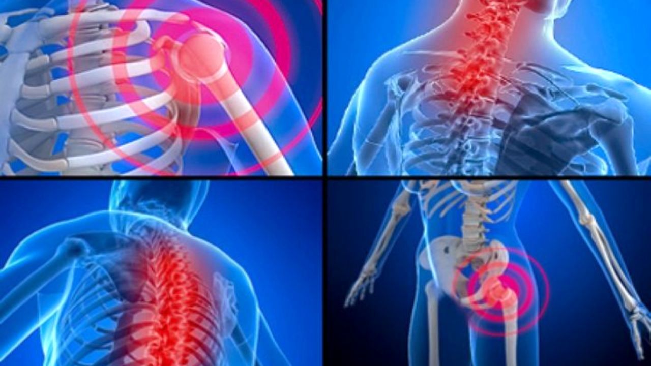 کاهش سن ابتلا به بیماری‌های اسکلتی عضلانی در ایران