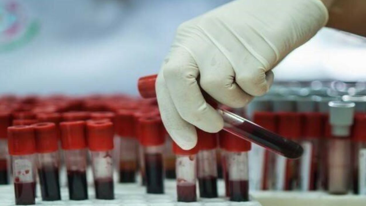 50 دستگاه سانتریفیوژ بانک خون ساخته می‌شود