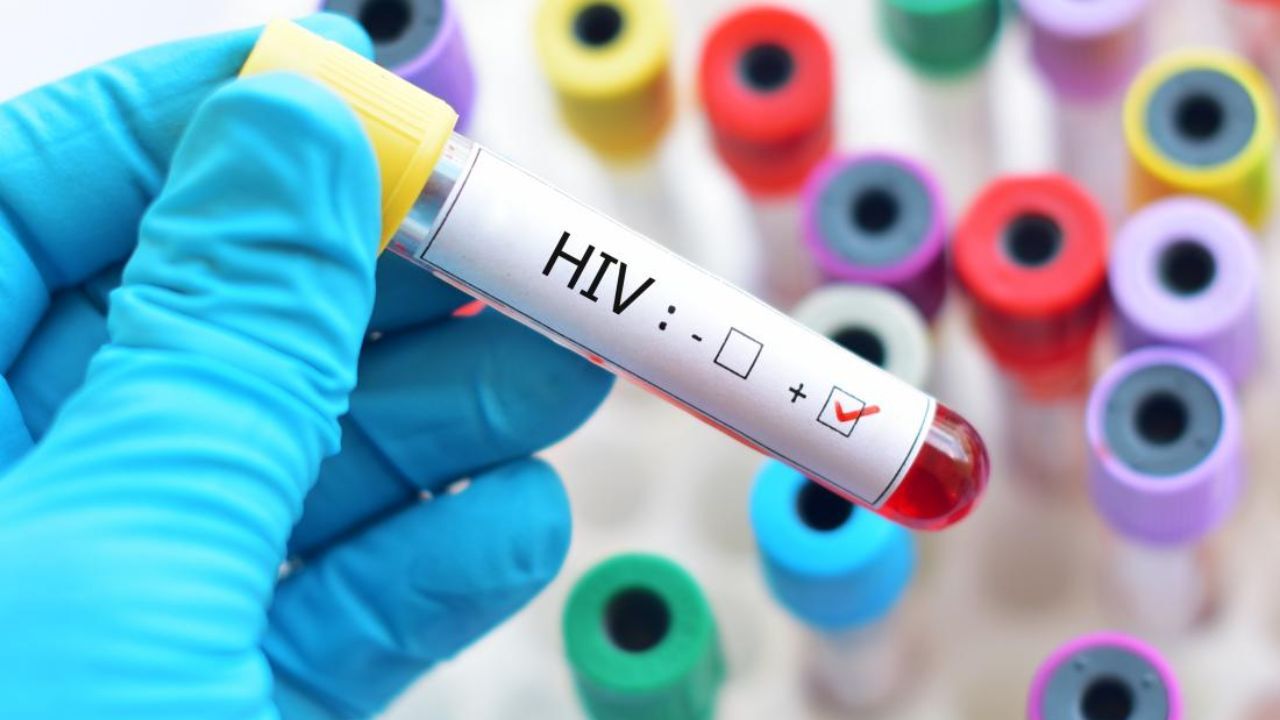 مبتلایان به HIV در معرض ابتلا به بیماری‌های قلبی قرار دارند