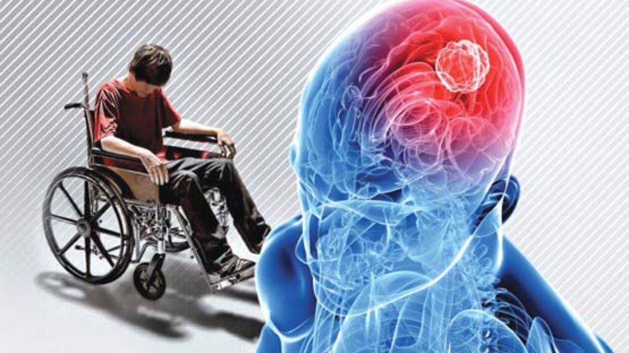 هزینه‌های درمانی ام‌اس با بیمه سلامت چقدر می‌شود؟