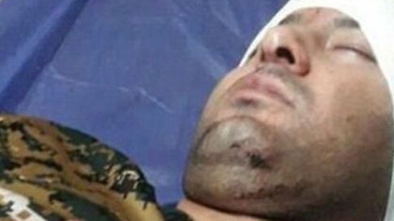 فعال محیط زیست با سلاح سرد مجروح شد