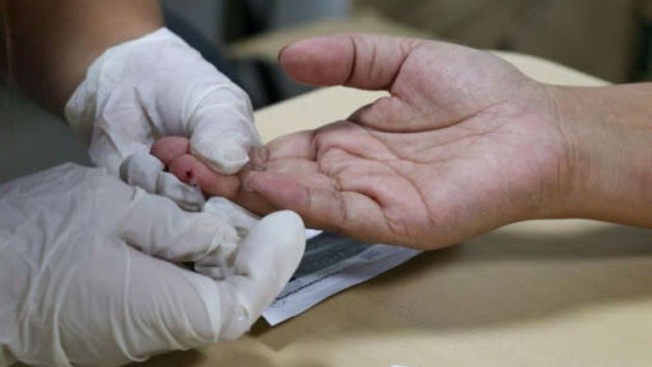 پوست، عامل انتقال کروناست؟