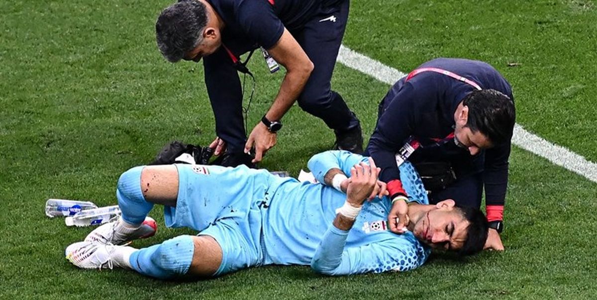 بیرانوند جام جهانی را از دست داد؟