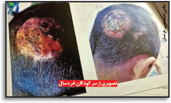 از کودک‌آزاری تا فروش گوشت الاغ در پرونده مردی که نفقه همسرش را نداد