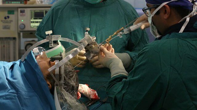 این علائم ساده می‌تواند نشانه تومور مغزی باشد