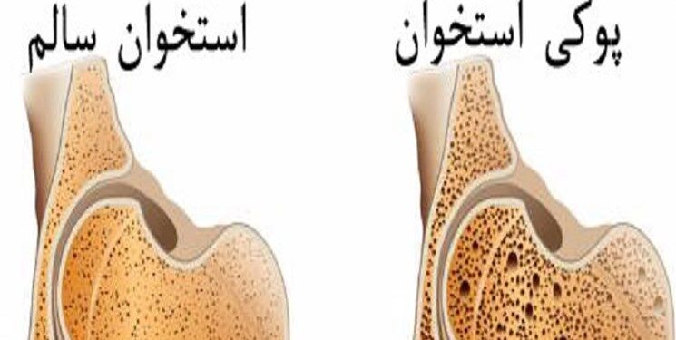 کدام غذاها برای استخوان مفید است؟